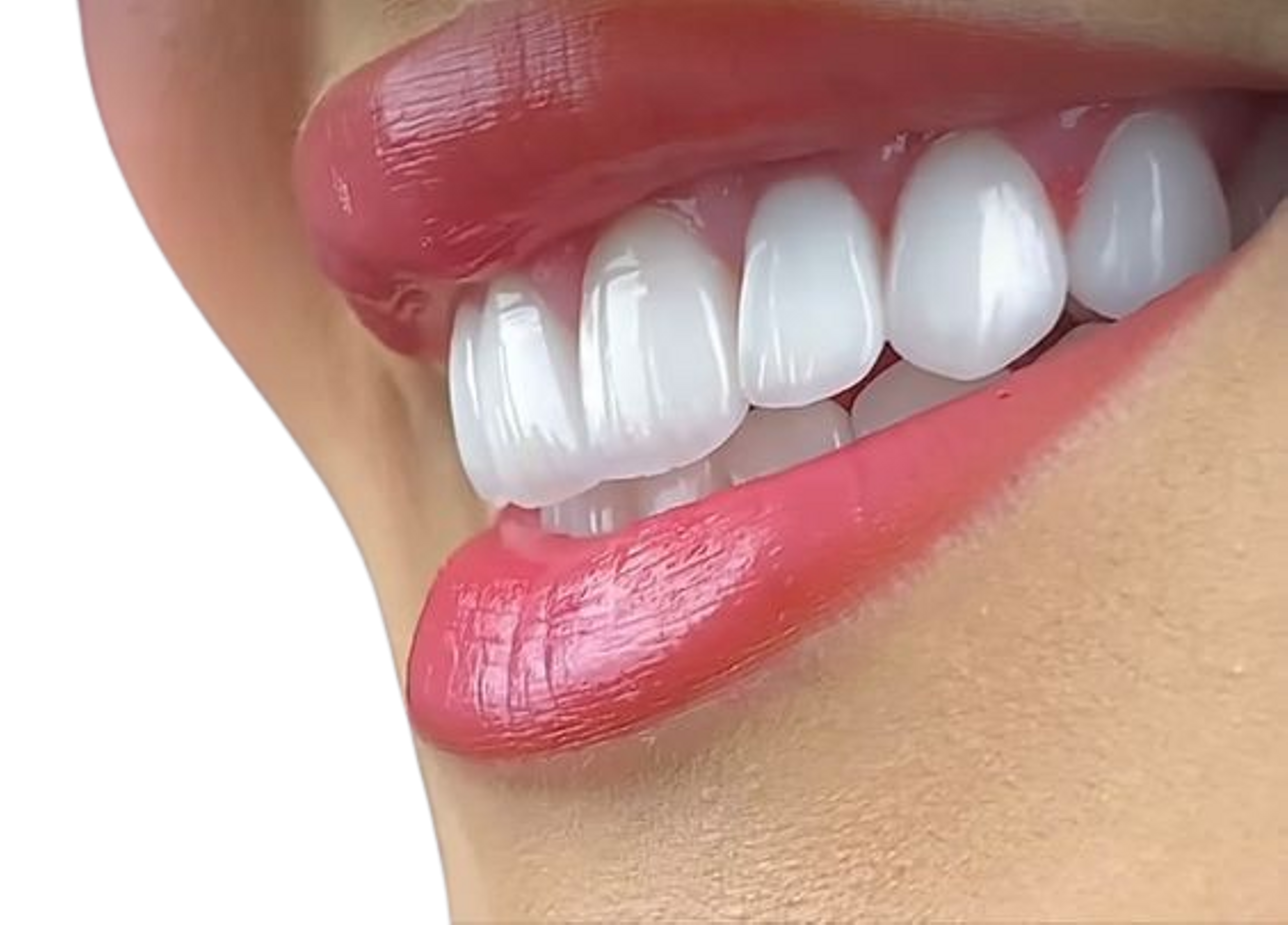 Cosmetic Dentistry